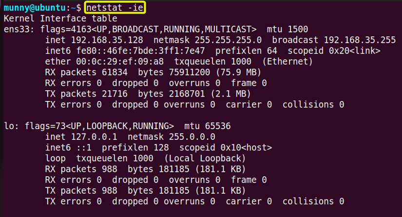 Display detailed information of all network interfaces.
